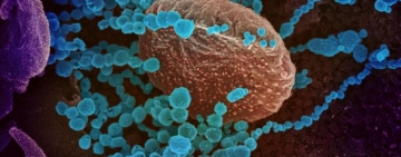 Confirman dos casos positivos de Covid-19 con la cepa amazónica o brasilera en Oruro