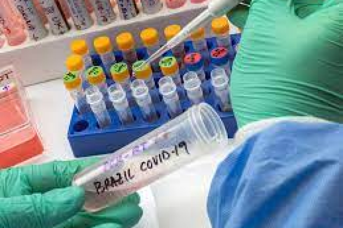 Detectan 20 casos de Covid-19 de la cepa amazónica o brasileña