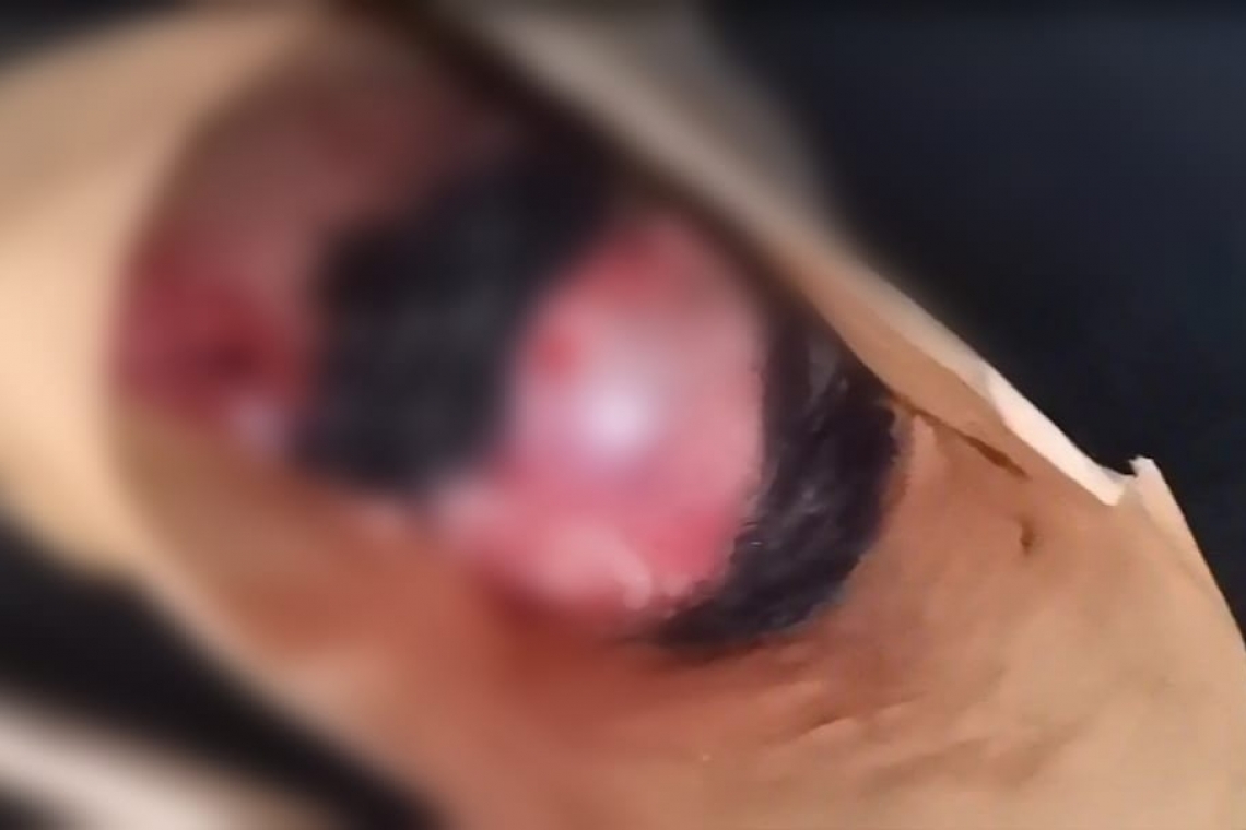 Encuentran restos de un feto que era devorado por canes