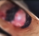 Encuentran restos de un feto que era devorado por canes