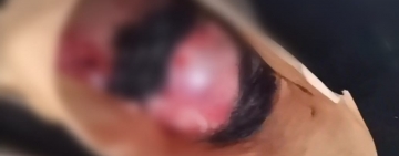 Encuentran restos de un feto que era devorado por canes