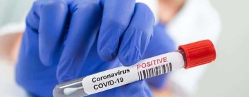 Casos de covid-19 en Oruro se incrementan en más del 100% en un día