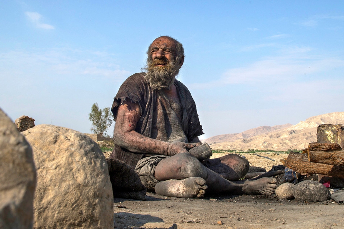 Muere a los 94 años el 'hombre más sucio del mundo' después de bañarse por primera vez en décadas