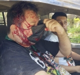 La ANP condena ataque de avasalladores de tierras contra periodista de El Deber