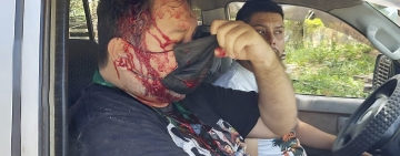 La ANP condena ataque de avasalladores de tierras contra periodista de El Deber