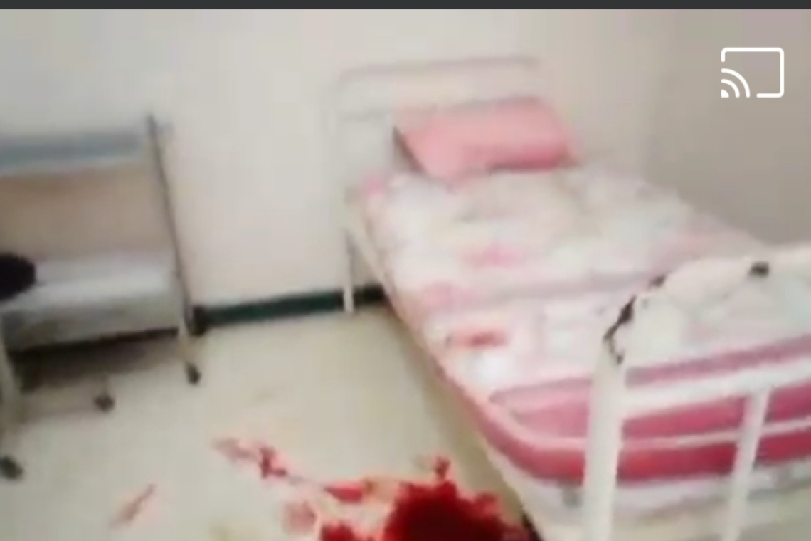 Por falta de atención médica bebé cae al piso de cabeza al nacer en Guanay