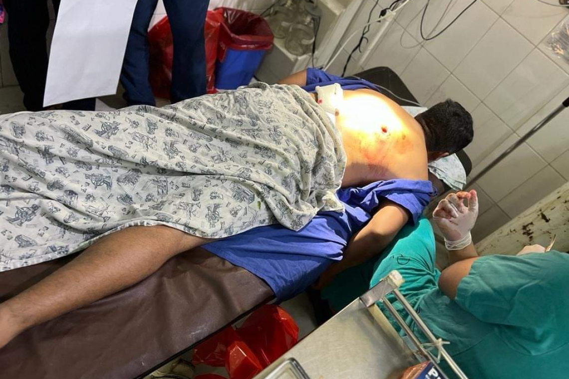 Emboscan a policías de UMOPAR tras descubrir fábrica en el Chapare, hay un herido