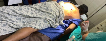 Emboscan a policías de UMOPAR tras descubrir fábrica en el Chapare, hay un herido