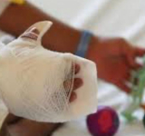 Muere niña quemada por su padre, se cambia el delito a infanticidio