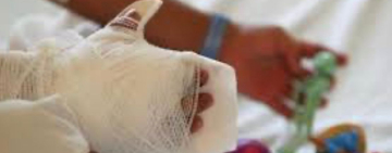 Muere niña quemada por su padre, se cambia el delito a infanticidio