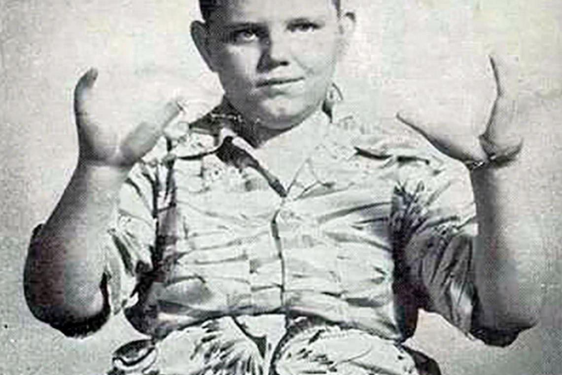 La terrible vida del “chico langosta”: un “circo freak”, un asesinato a sangre fría y un triste final