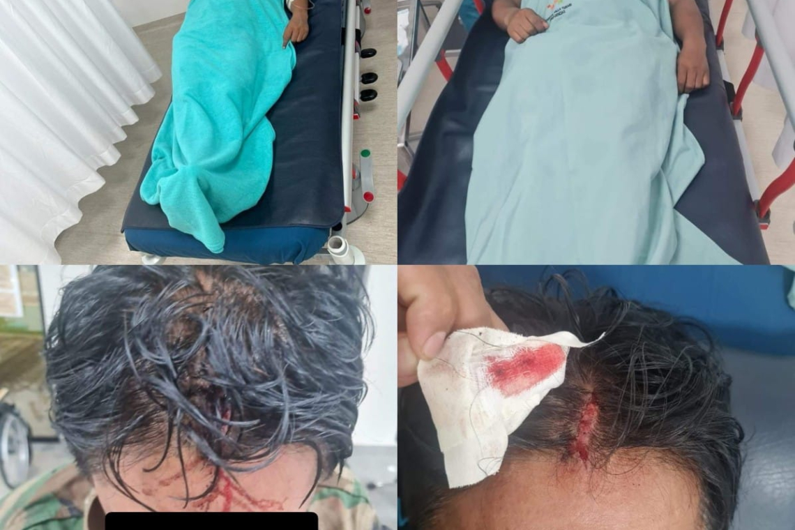 En emboscada cobarde hieren a tres efectivos antidroga en el Chapare