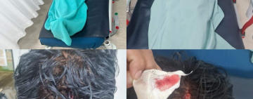 En emboscada cobarde hieren a tres efectivos antidroga en el Chapare