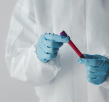 Una persona muere en EE.UU. por un virus que hace sangrar los ojos 