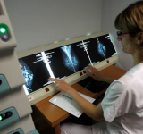 El cáncer tiene un nuevo rostro: crecen los casos en adultos jóvenes y mujeres