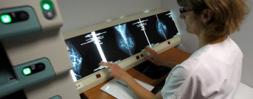 El cáncer tiene un nuevo rostro: crecen los casos en adultos jóvenes y mujeres