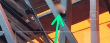 Joven de 21 años que perdió un dedo en una gradería en Oruro está estable 