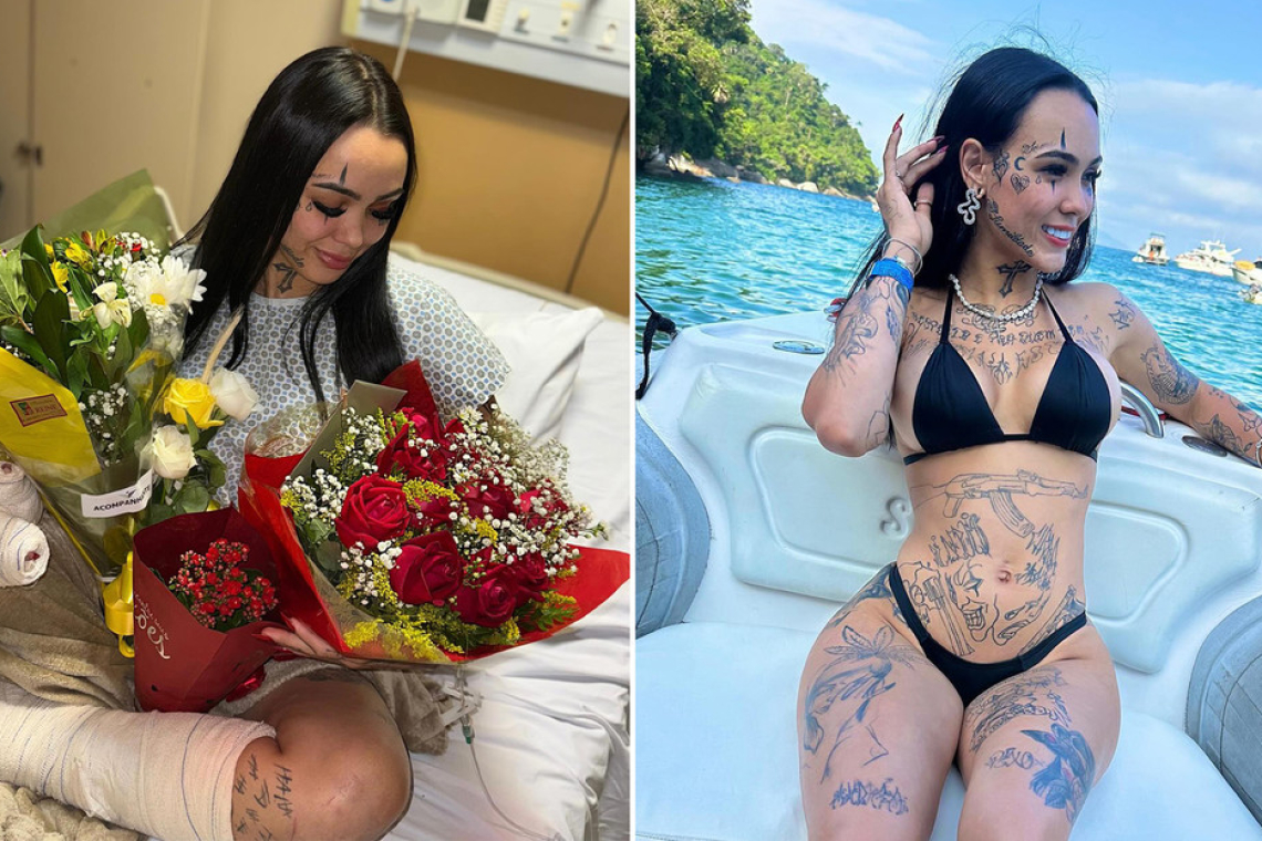 'Influencer' brasileña sufre brutal ataque de su ex y muestra sus heridas en vivo