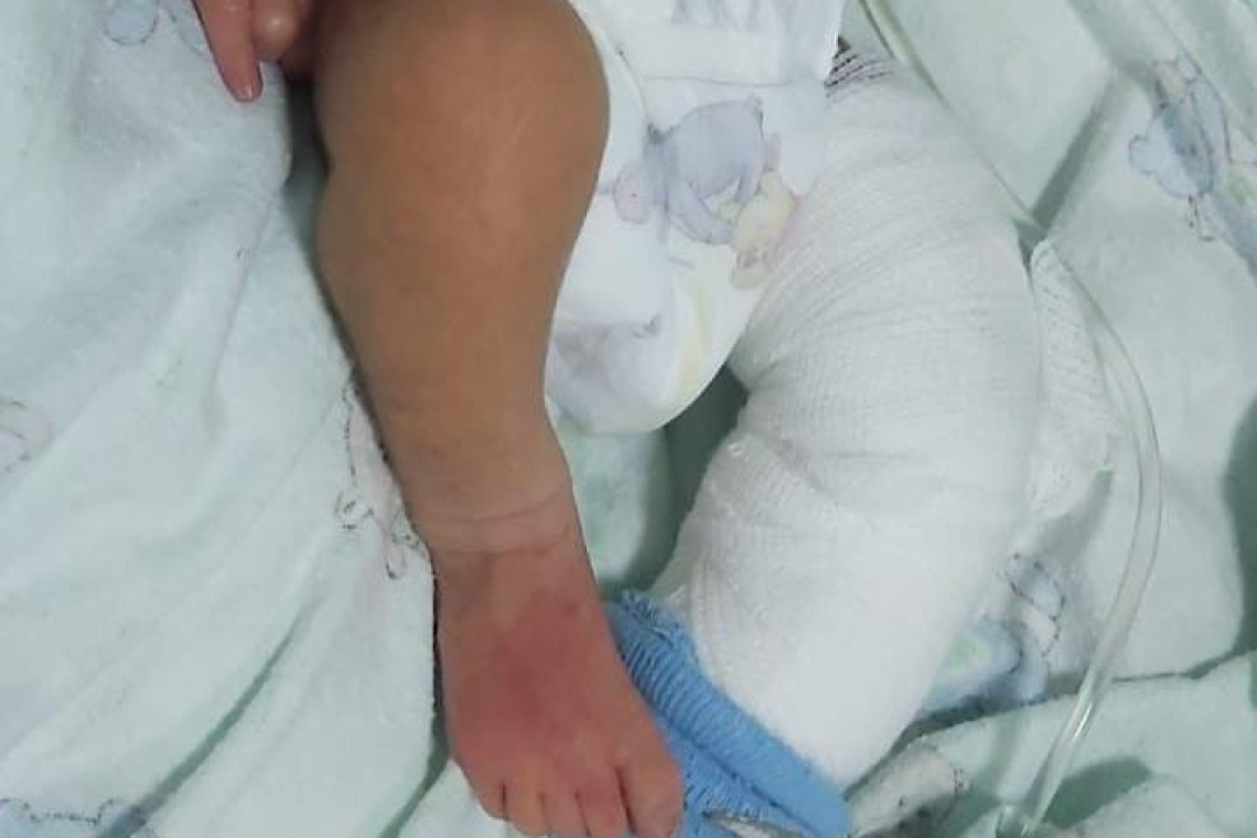 Recién nacido sufre quemaduras y Fiscalía investiga contra implicados